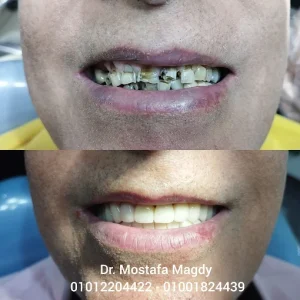 Inshot 20230607 175843243